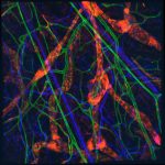 Mouse skin. Red: lymphatic vessels, Green: blood vessels, Blue: Neurons. Image by Akira Takeda