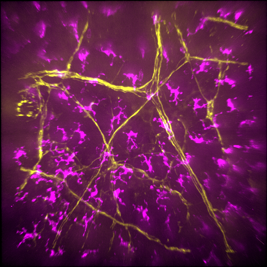 Mouse skin. Yellow: neuron, Magenta: T cells. Image by Akira Takeda.